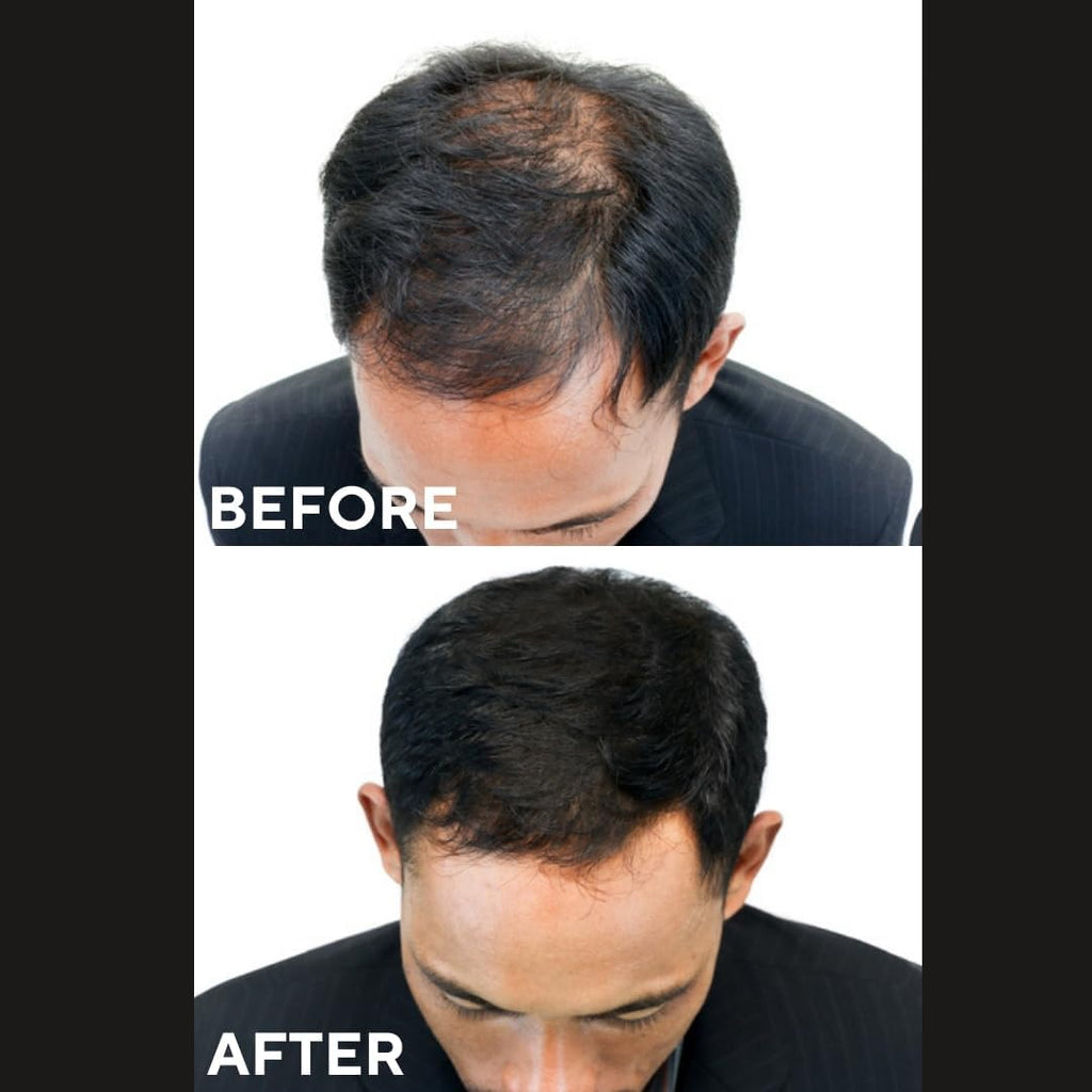 Ceelini sprej za gustu kosu sa keratinskim vlaknima - prirodan volumen i pun izgled za 15 sekundi (100 ml)